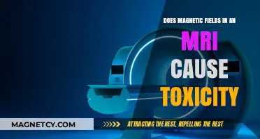Exploring MRI Safety: Do Magnetic Fields Induce Toxicity?