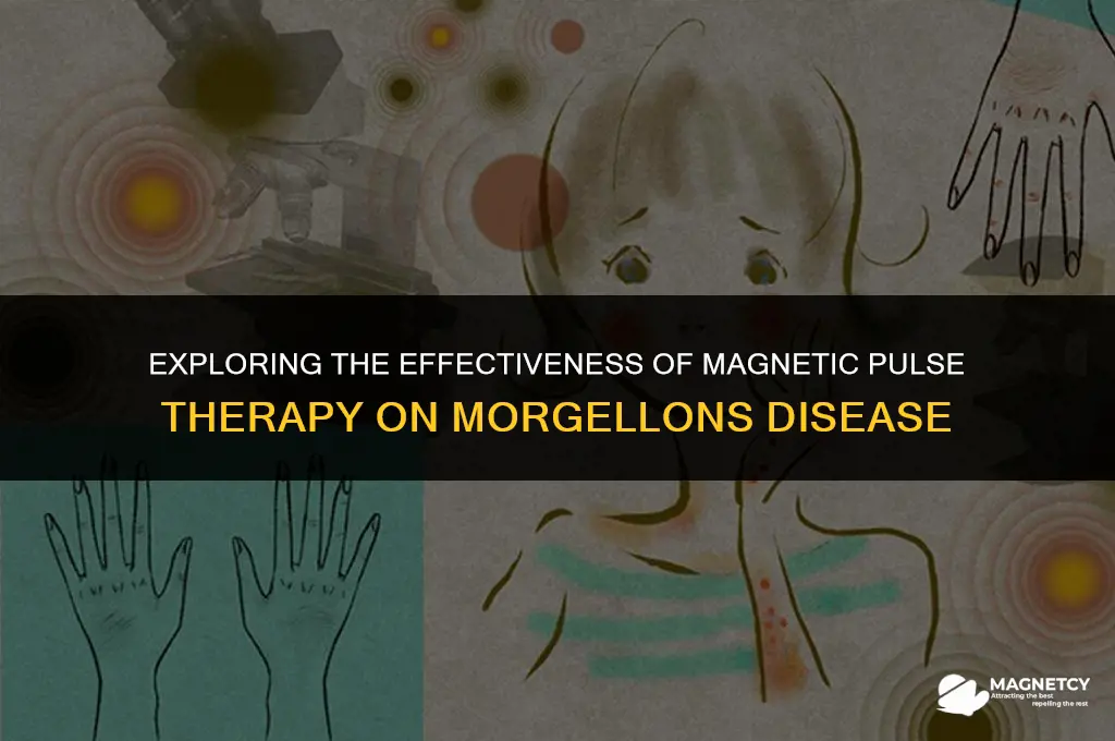 does magnetic pulse work on morgellons