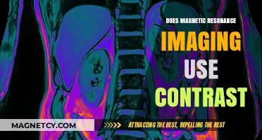 Understanding MRI Contrast: How Magnetic Resonance Imaging Utilizes Contrast Agents