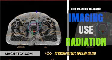 Does MRI Use Radiation? Uncovering the Truth About Magnetic Resonance Imaging