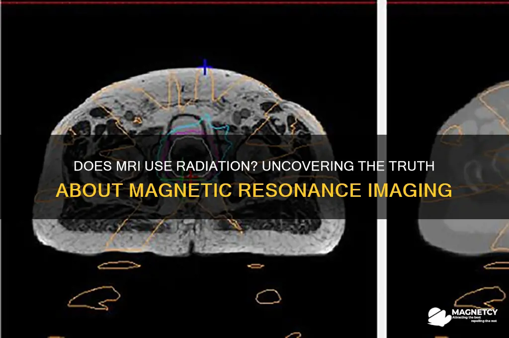 does magnetic resonance imaging use radiation