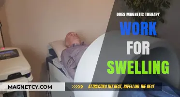 Exploring the Effectiveness of Magnetic Therapy in Reducing Swelling