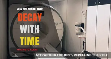 Exploring the Longevity of MRI Magnet Fields: A Comprehensive Analysis