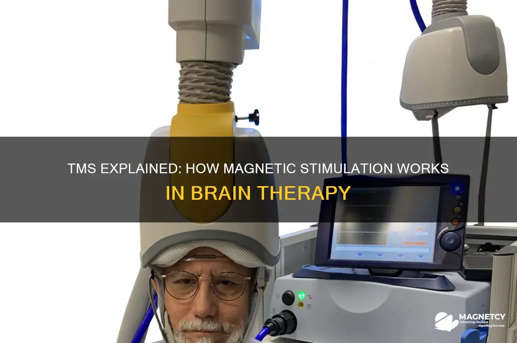 does tms use magnetic stimulation