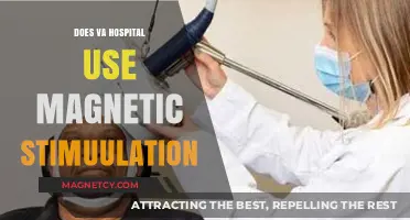 Exploring Magnetic Stimulation Therapy at VA Hospitals: Benefits and Uses