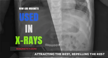 Magnetic Power in X-Rays: Unlocking Advanced Medical Imaging Techniques