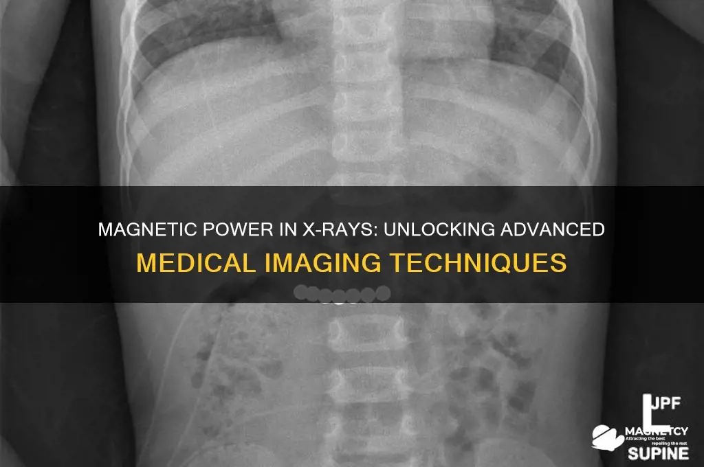 how are magnets used in x-rays