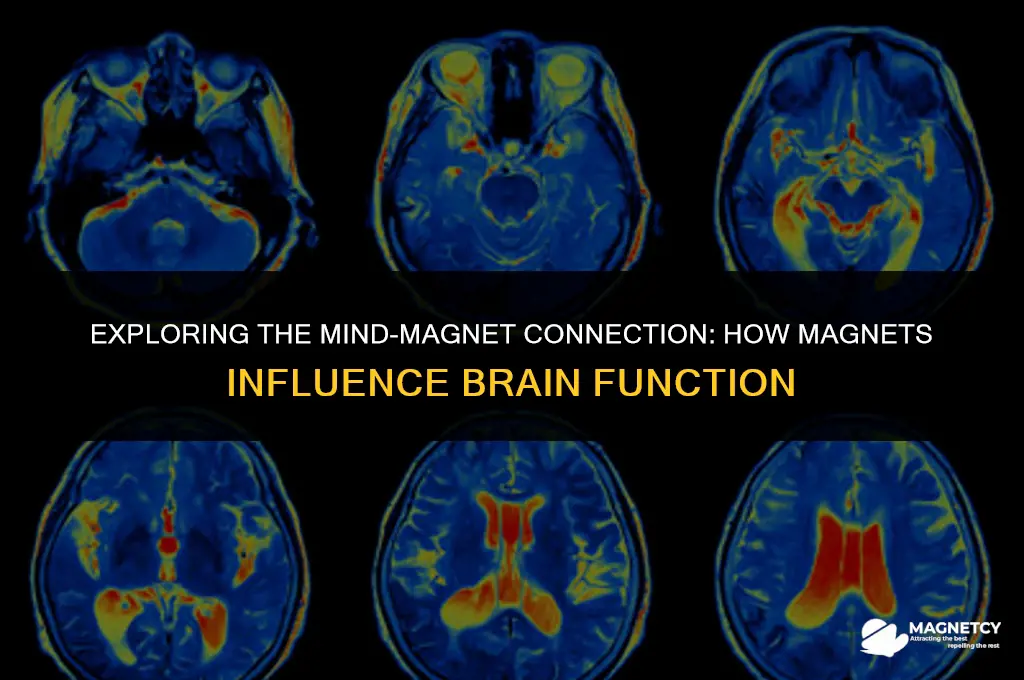 how do magnets work on the brain