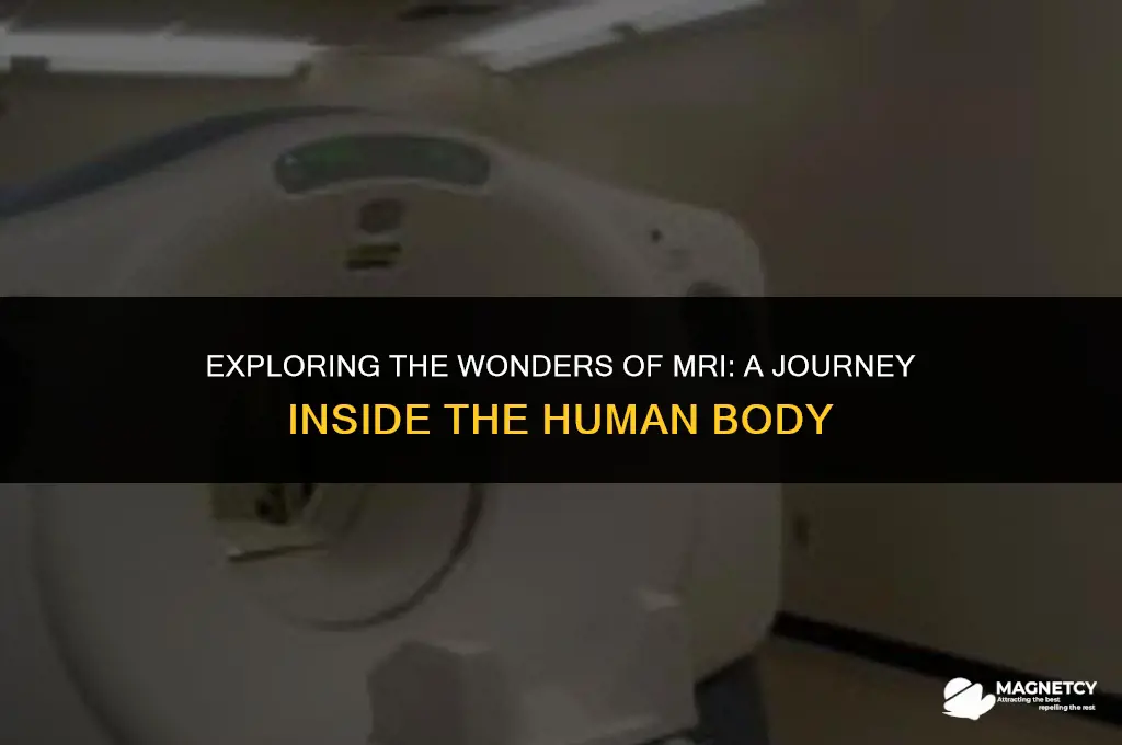 how does magnetic resonance imaging work