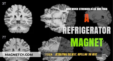 Unleashing the Power: MRI Strength vs. Refrigerator Magnetism