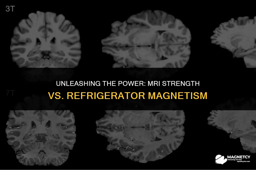 how much stronger is an mri than a refrigerator magnet