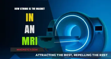 Exploring the Power of MRI Magnets: A Deep Dive into Their Strength