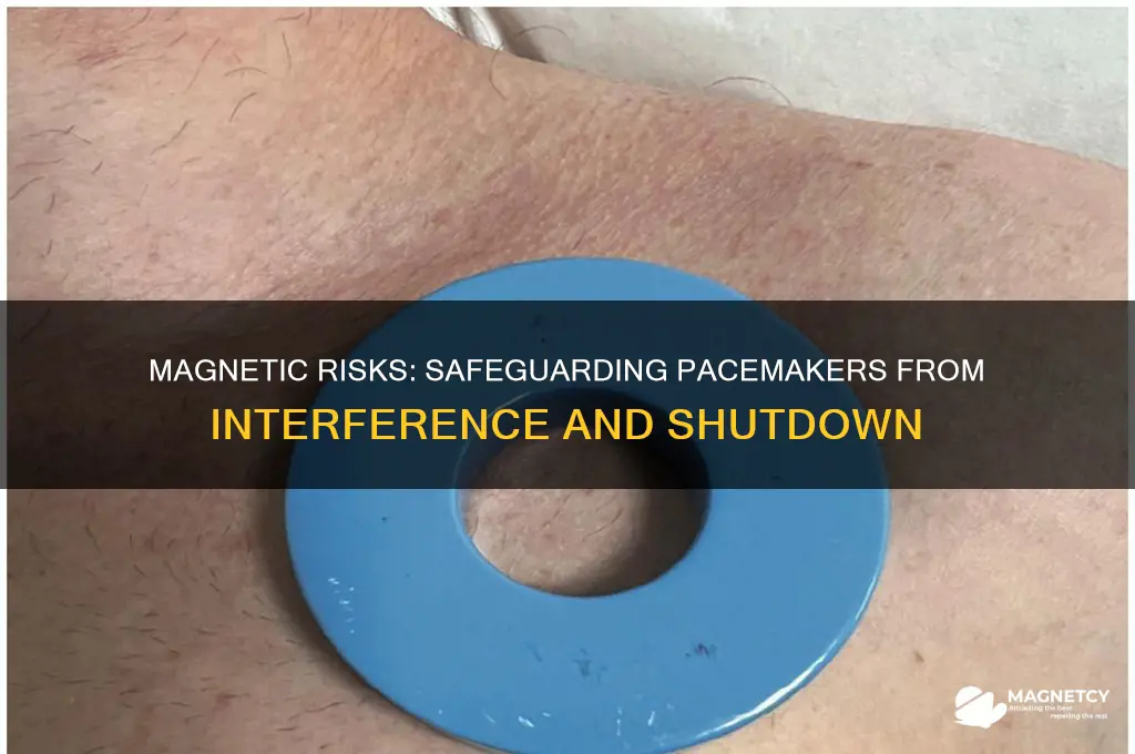 how to use magnet to turn off pacemaker