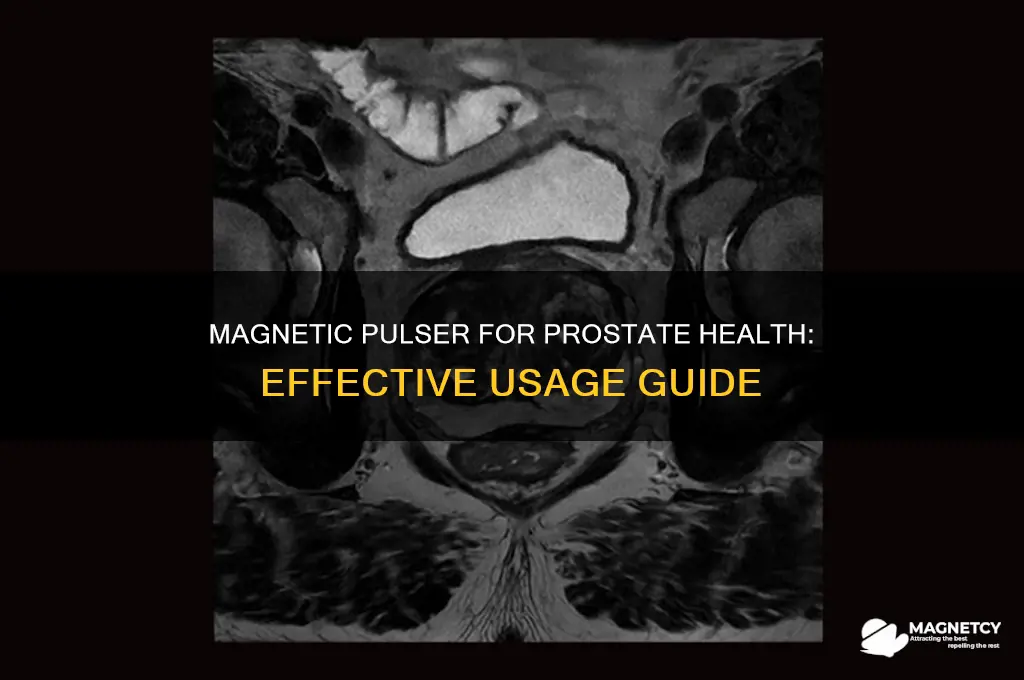 how to use the magnetic pulser for prostate