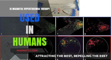 Magnetic Hyperthermia Therapy: Current Human Applications and Future Potential