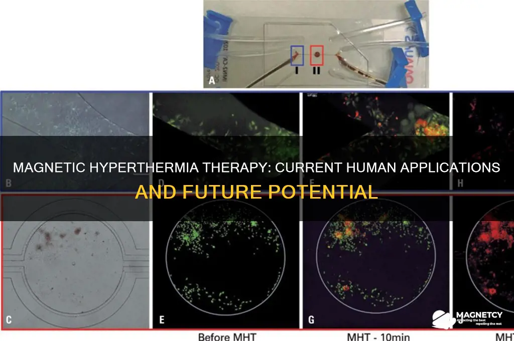 is magnetic hyperthermia therapy used in humans