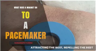 Pacemaker Safety: Understanding the Effects of Magnets on Your Device