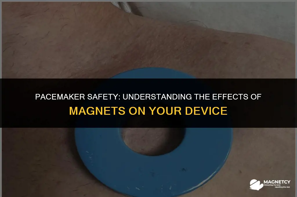 what does a magnet do to a pacemaker