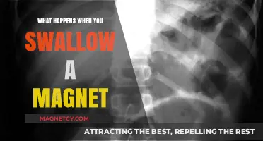 The Surprising Effects of Swallowing a Magnet: A Medical Mystery Unveiled