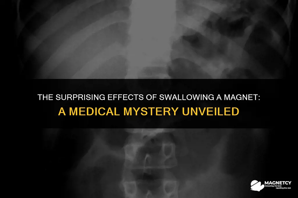 what happens when you swallow a magnet