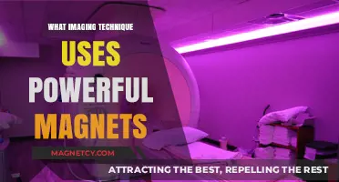 Unveiling MRI: How Powerful Magnets Revolutionize Medical Imaging Techniques
