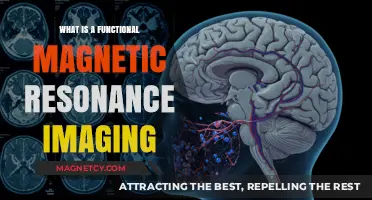 Exploring the Mind: What is Functional Magnetic Resonance Imaging?