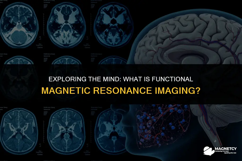 what is a functional magnetic resonance imaging