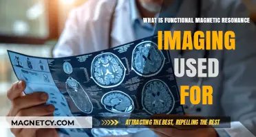 Exploring Functional MRI: Applications in Brain Research and Medical Diagnostics