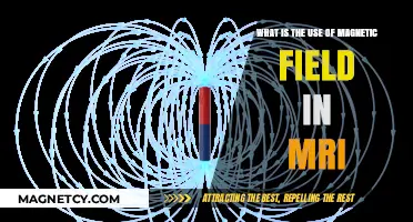 Understanding MRI: How Magnetic Fields Create Detailed Body Imaging
