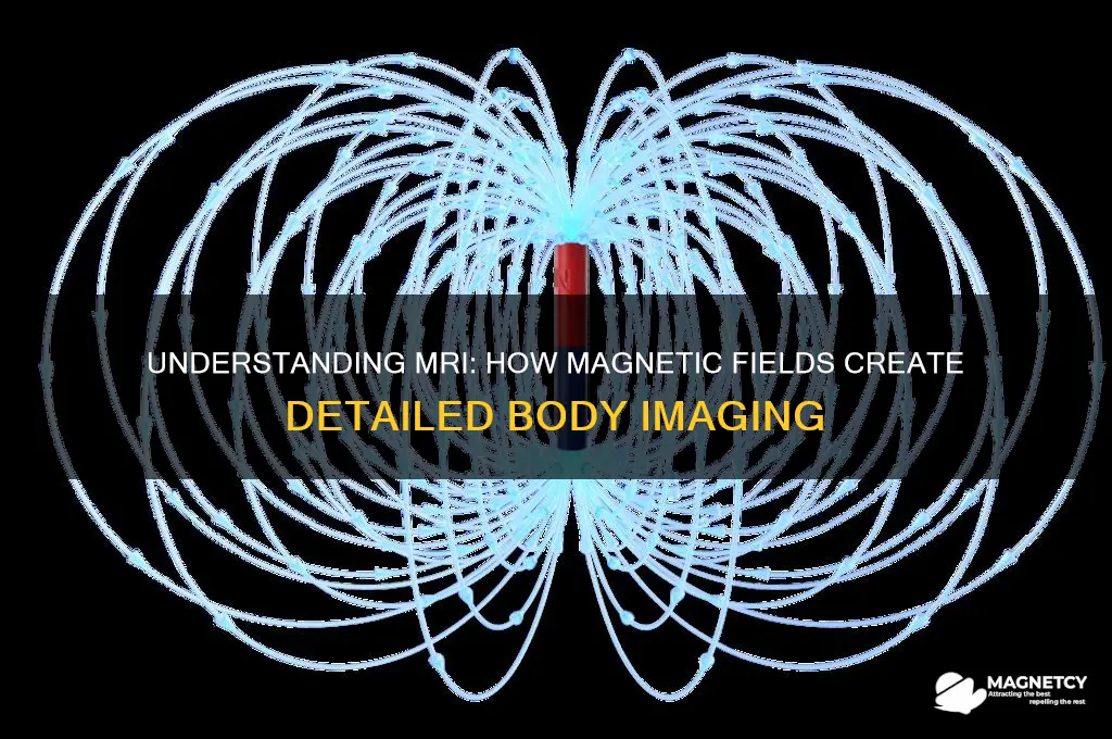 what is the use of magnetic field in mri