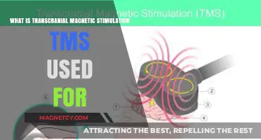 Exploring TMS: Uses and Benefits of Transcranial Magnetic Stimulation