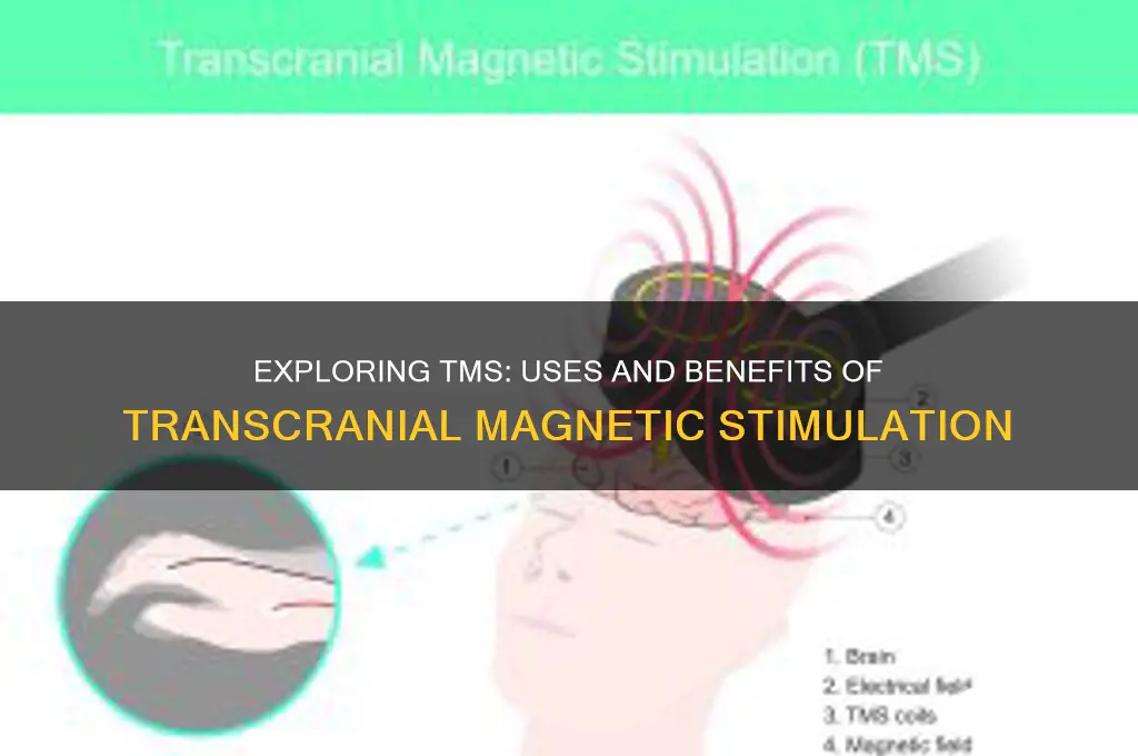 what is transcranial magnetic stimulation tms used for