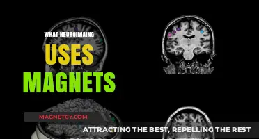 Magnetic Insights: How Neuroimaging Uses Magnets to Map the Brain