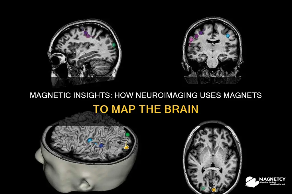 what neuroimaing uses magnets