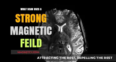 MRI Scans: Harnessing Strong Magnetic Fields for Detailed Imaging
