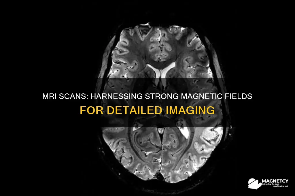 what scan uses a strong magnetic feild