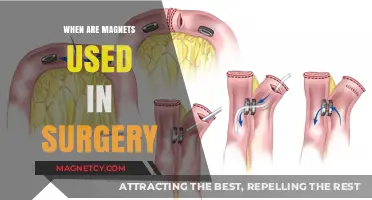 Magnetic Innovations: How Magnets Are Revolutionizing Modern Surgical Procedures