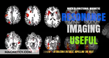 When Functional MRI Shines: Key Applications and Benefits Explained