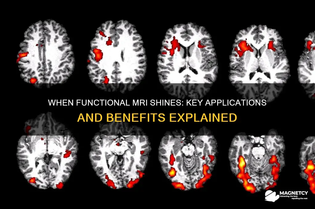 when is functional magnetic resonance imaging useful