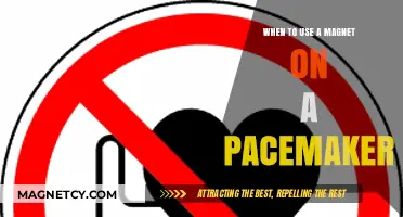 Pacemaker Safety: When and Why to Avoid Magnets Nearby