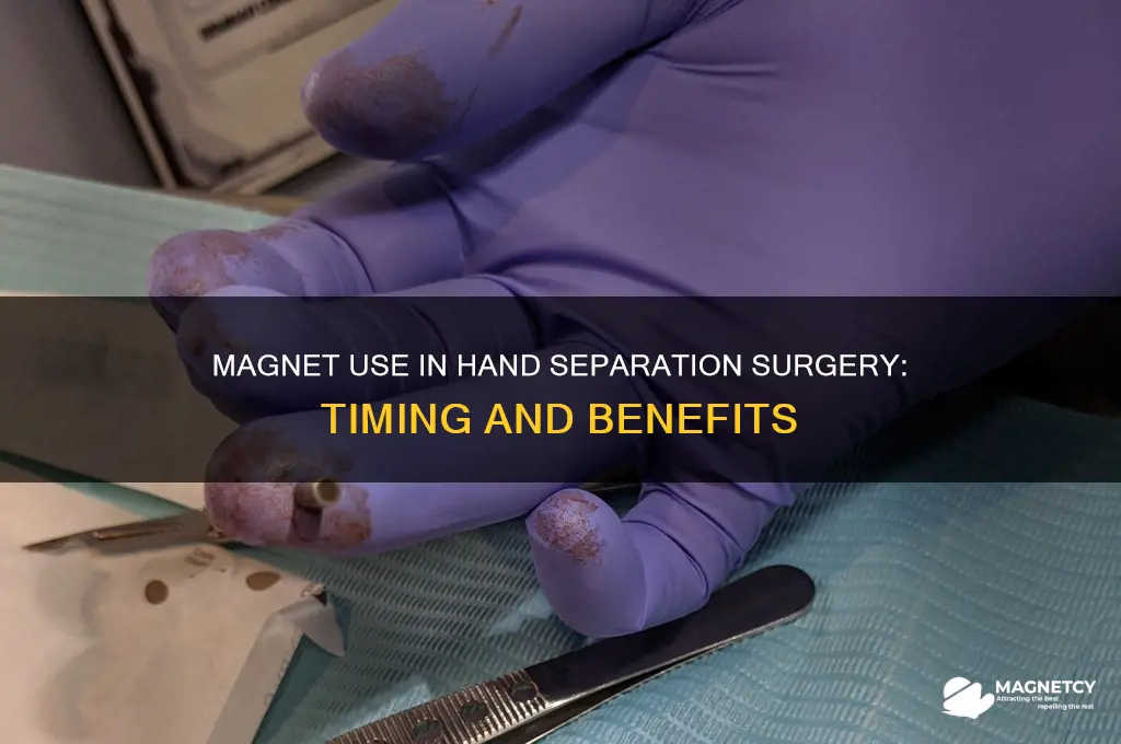 when would a magnet be used during hand separation