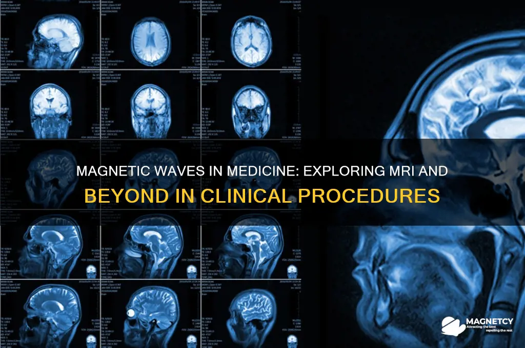 which clinical procedure uses magnetic waves