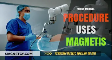 Magnetic Marvels: Exploring Medical Procedures Powered by Magnetism