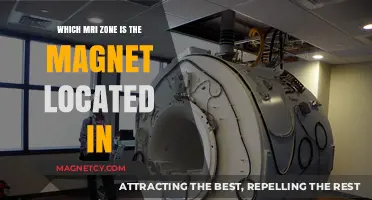 Understanding MRI Zones: Where is the Magnet Really Located?