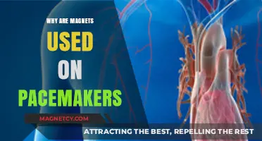 Magnets and Pacemakers: Understanding Their Crucial Medical Interaction