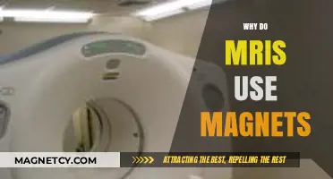 Unveiling the Magnetic Power: How MRIs Revolutionize Medical Imaging