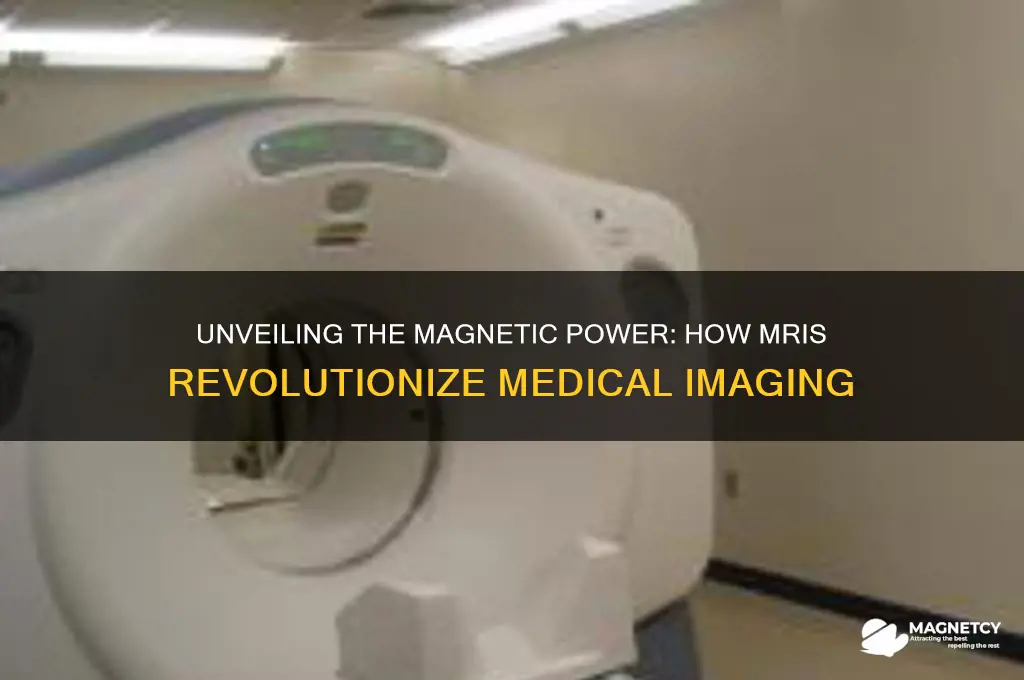 why do mris use magnets